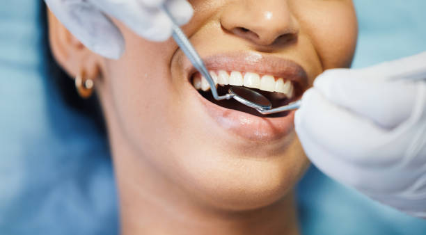 Best Walk-In Emergency Dentist in Paris, MO